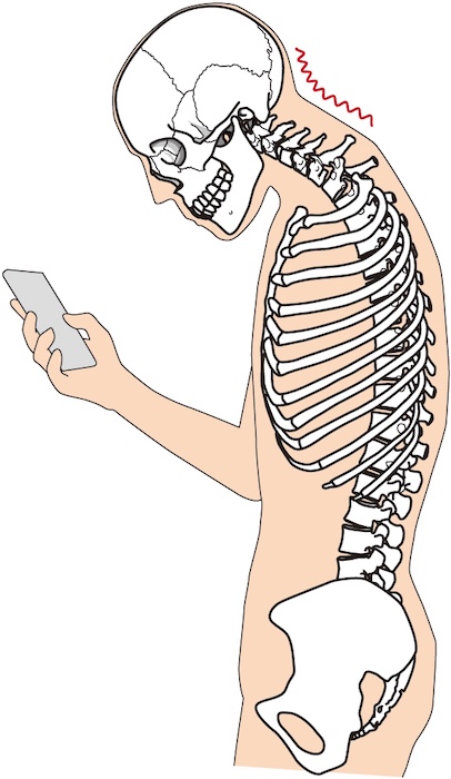 スマホを見つつ、首に負担がかかる姿勢を取っている骨格図