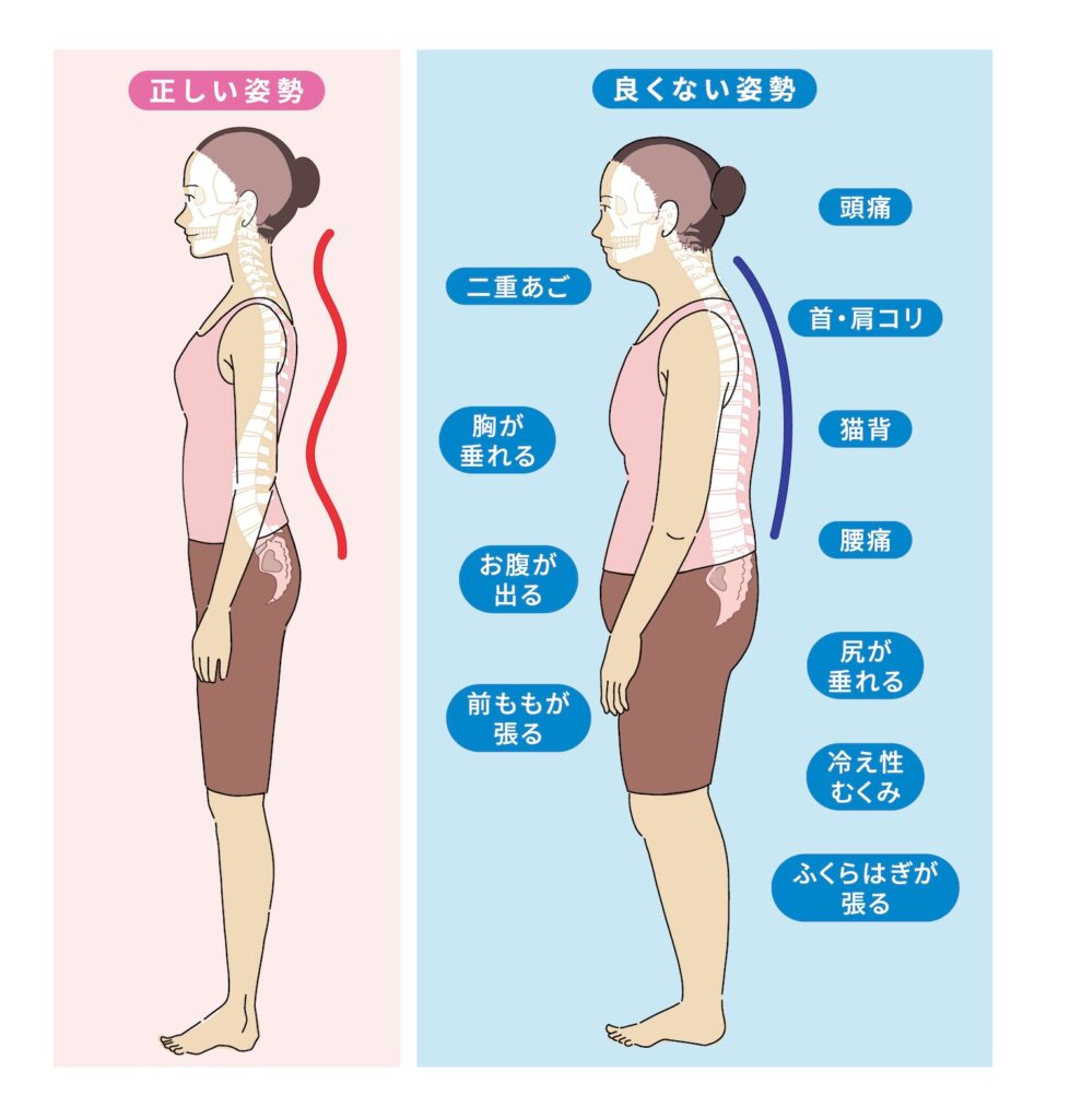 正しい姿勢と骨盤を後継させた姿勢の比較