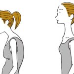 猫背と健康的な姿勢の女性