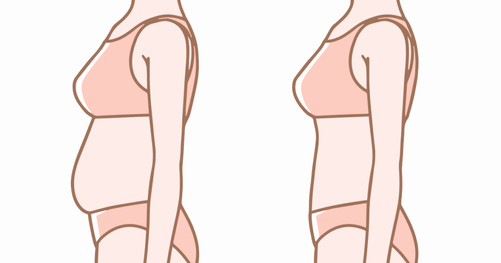 ぽっこりお腹とくびれのあるお腹の違い